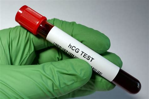 pregnancy blood test 